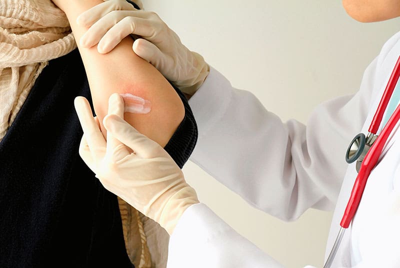 psoriasis crema